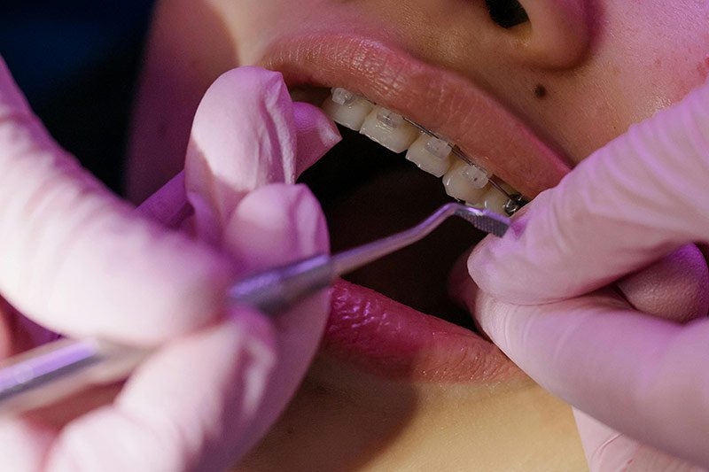 Contacta con Clínica Dental Palacio