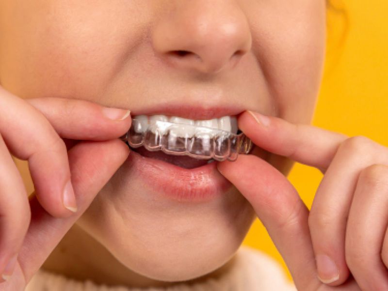 bruxismo atm oclusion santander