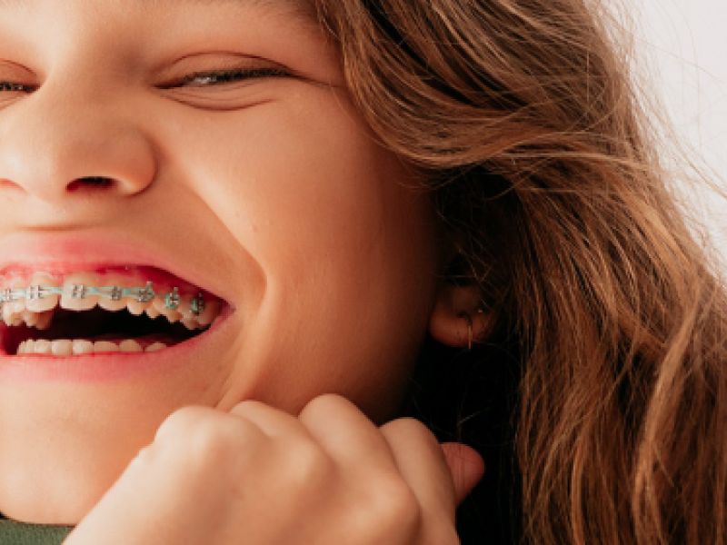Ortodoncia en Santander