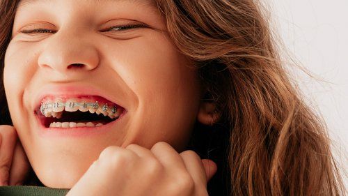 Ortodoncia en Santander