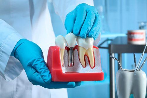 Servicios de odontología general