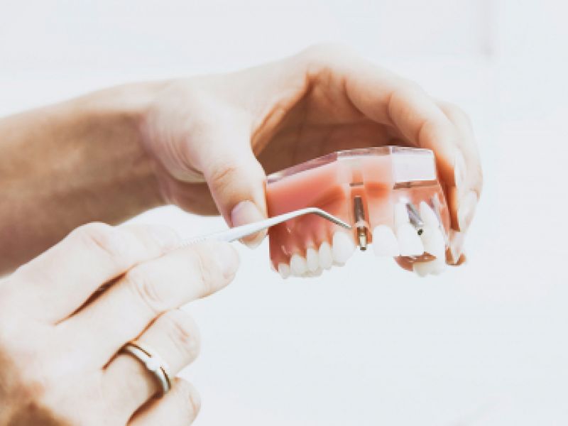 tratamientos odontologia general santander