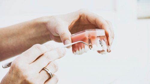 Ortodoncia en Santander