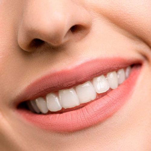 quieres transformar tu sonrisa